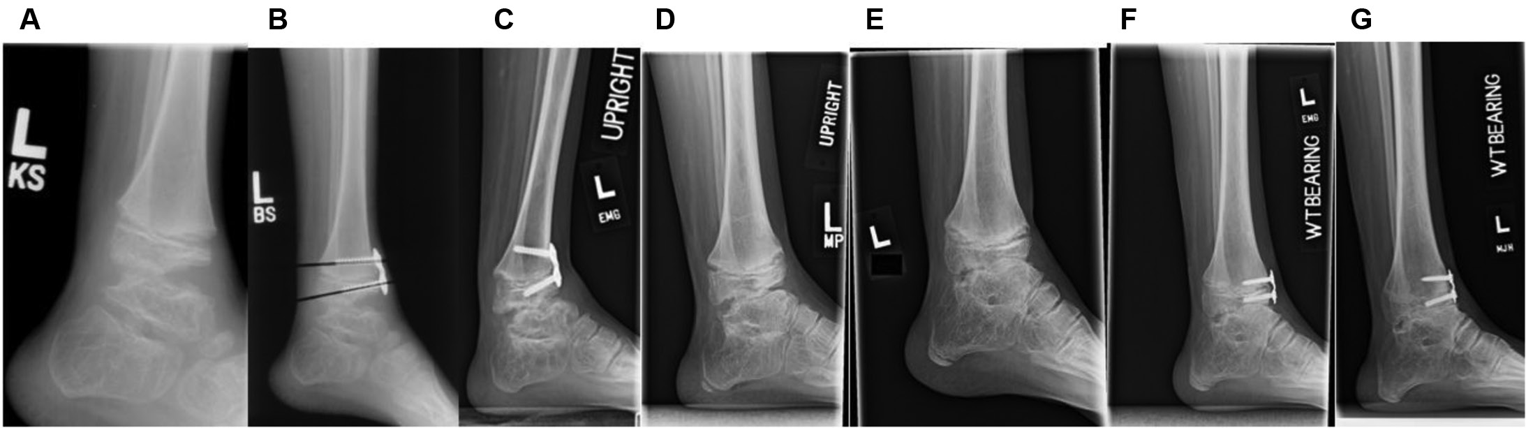 jposna20220004_fig3.jpg