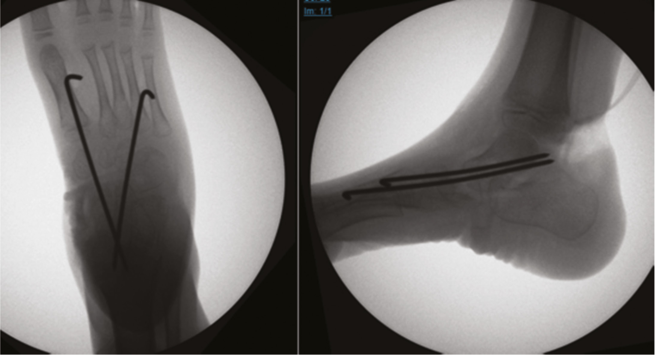 jposna20220002_fig16.jpg
