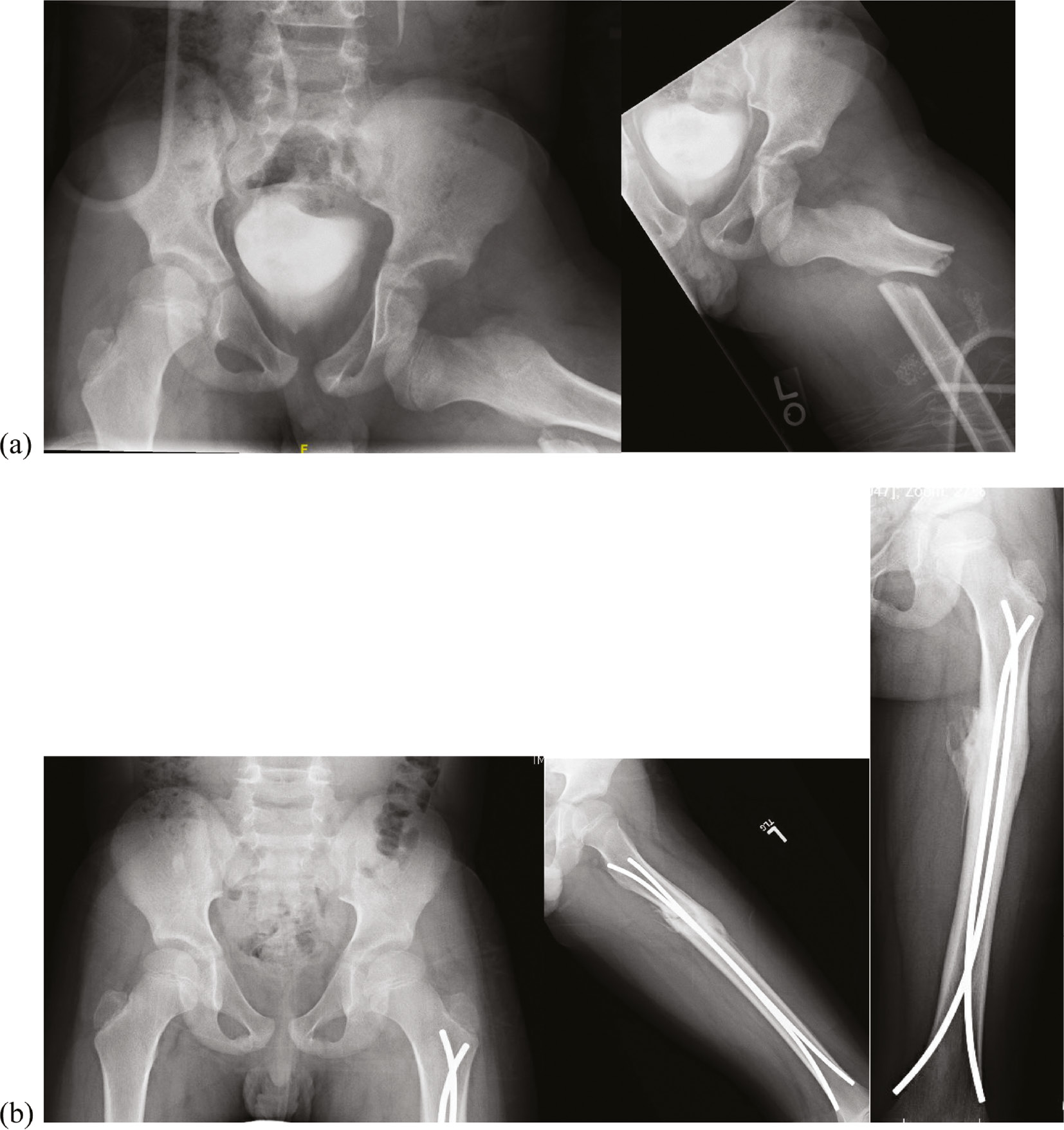 jposna20220034_fig1.jpg