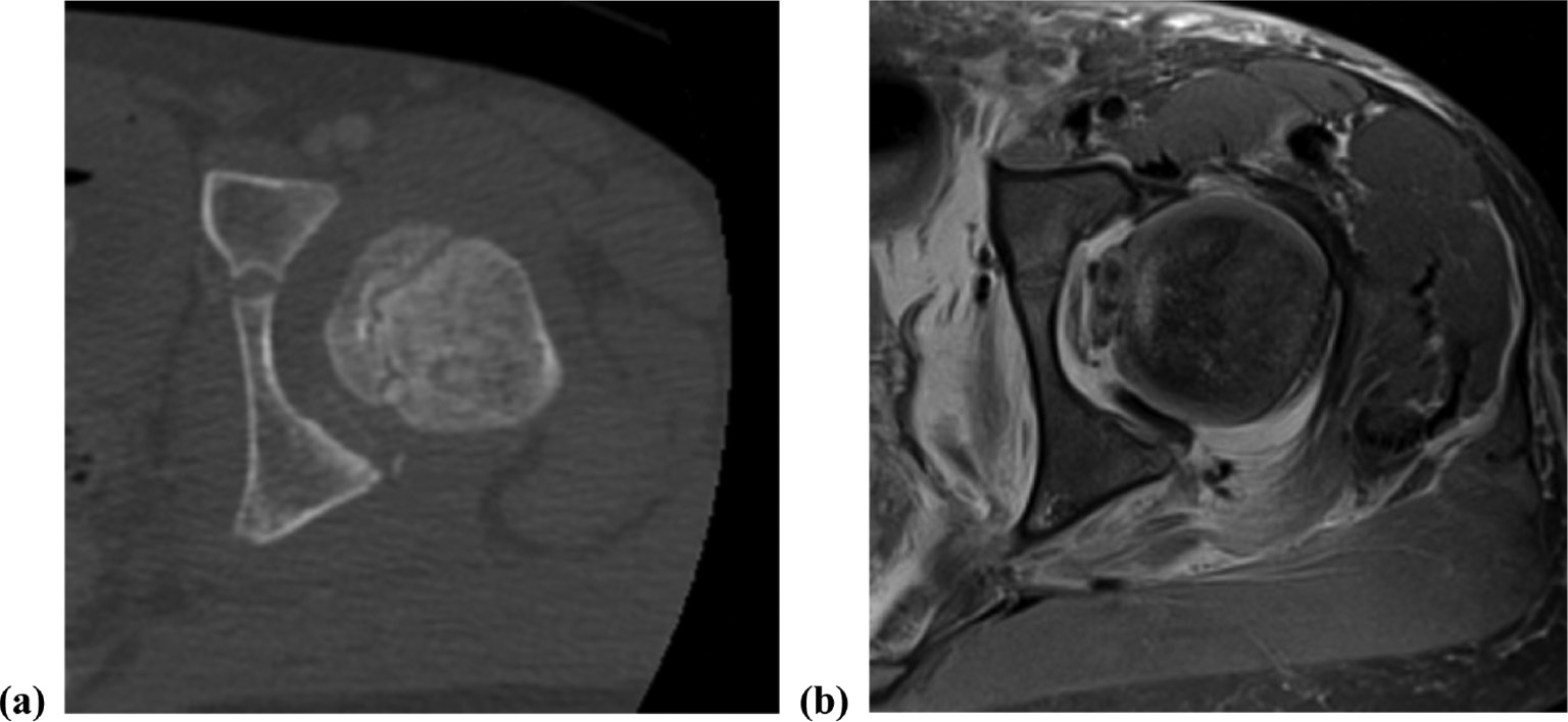 jposna20220034_fig2.jpg