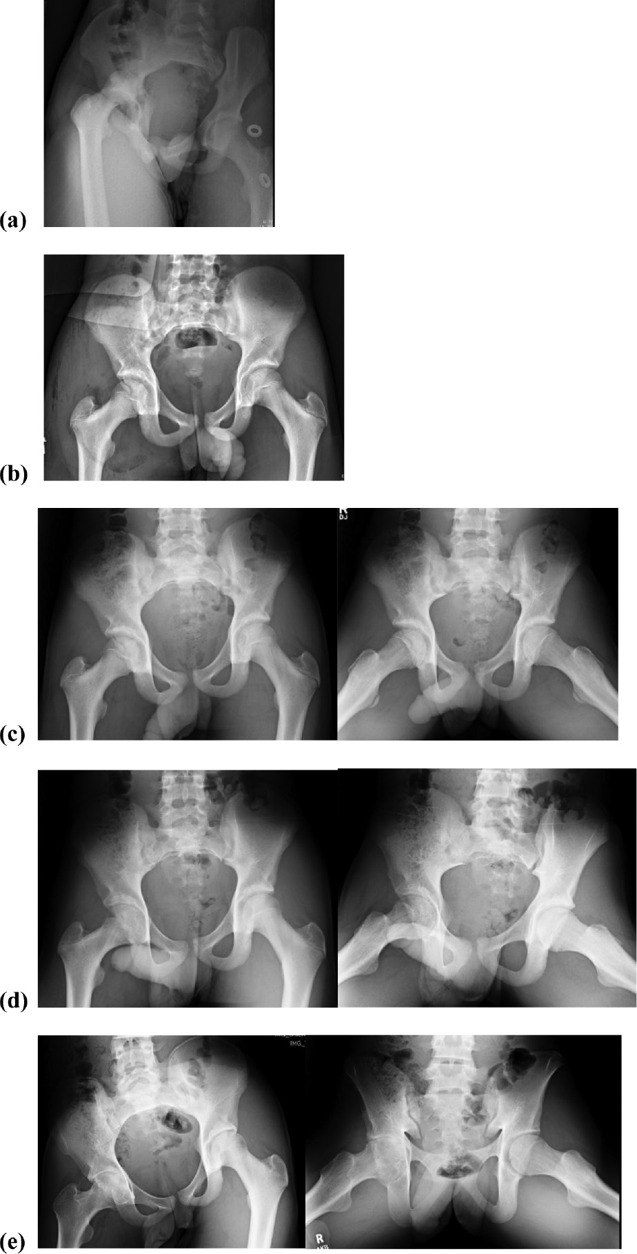 jposna20220034_fig5.jpg