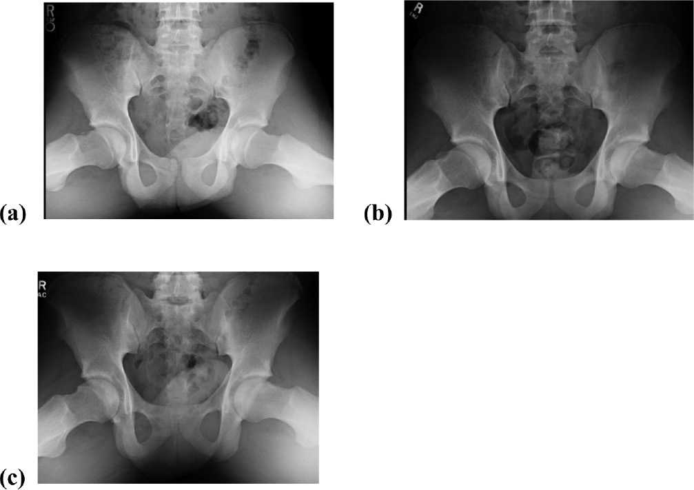 jposna20220034_fig6.jpg