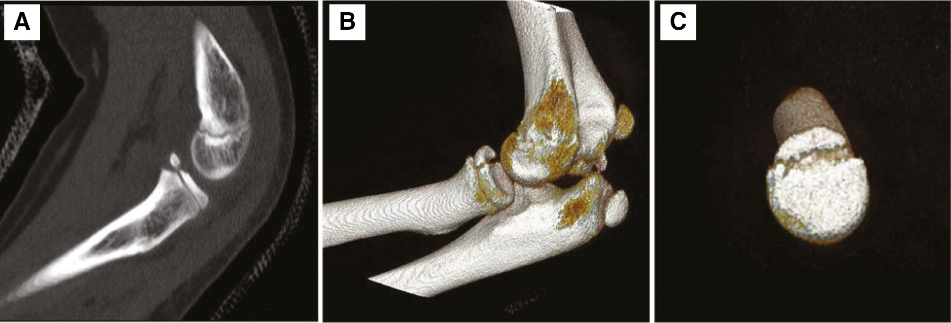 jposna2022440_fig1.jpg