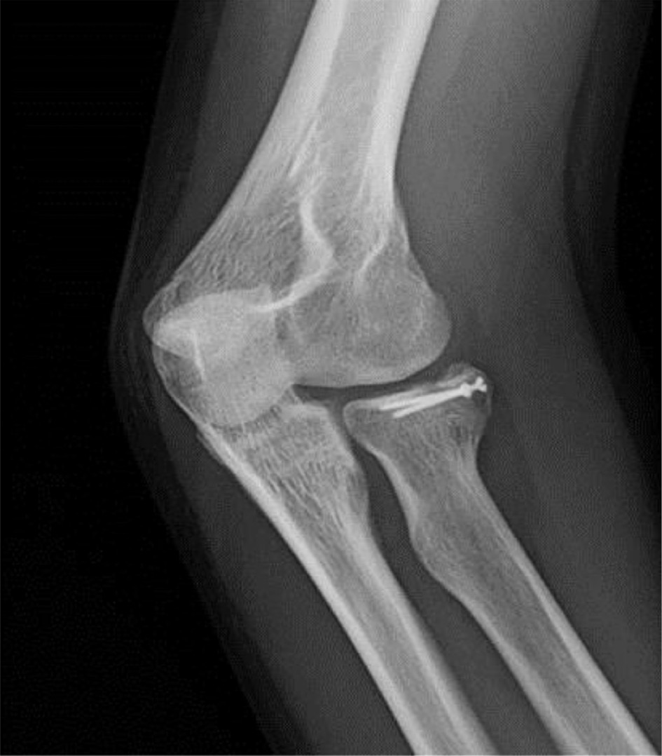jposna2022440_fig4.jpg