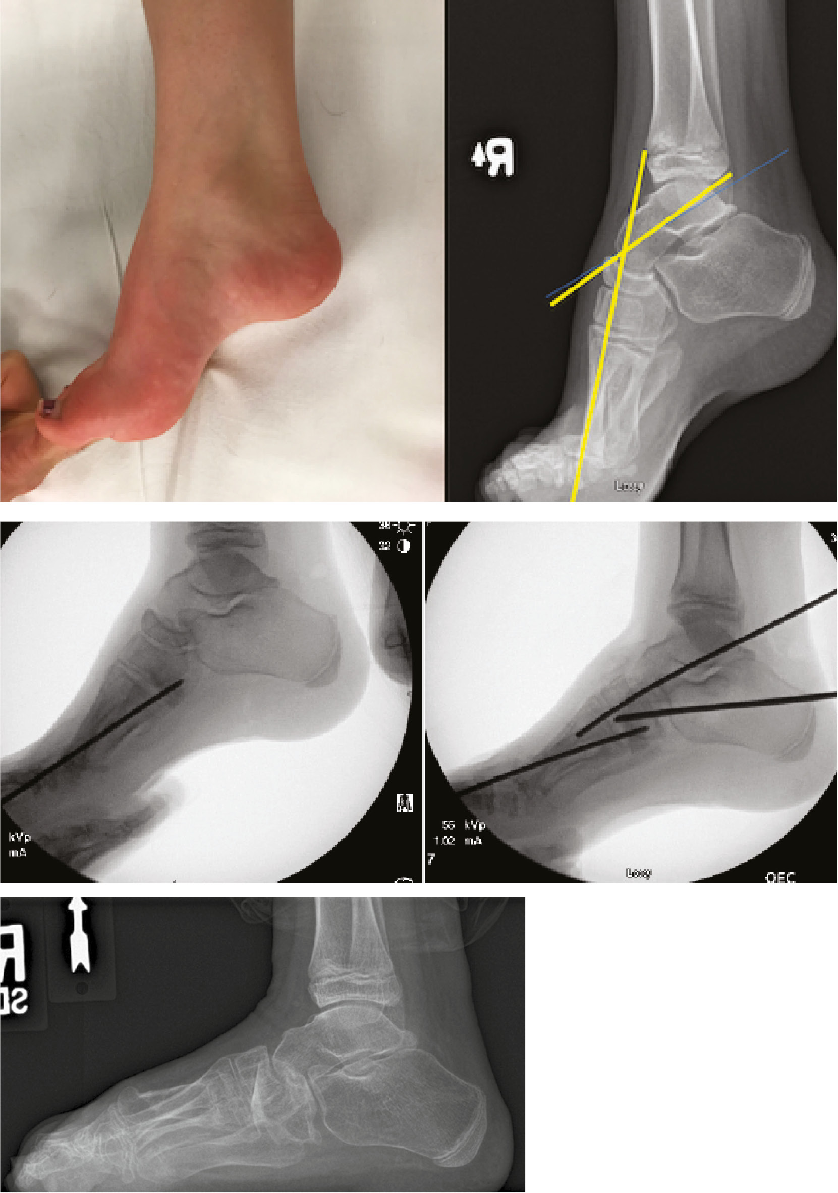 jposna20220035_fig16.jpg