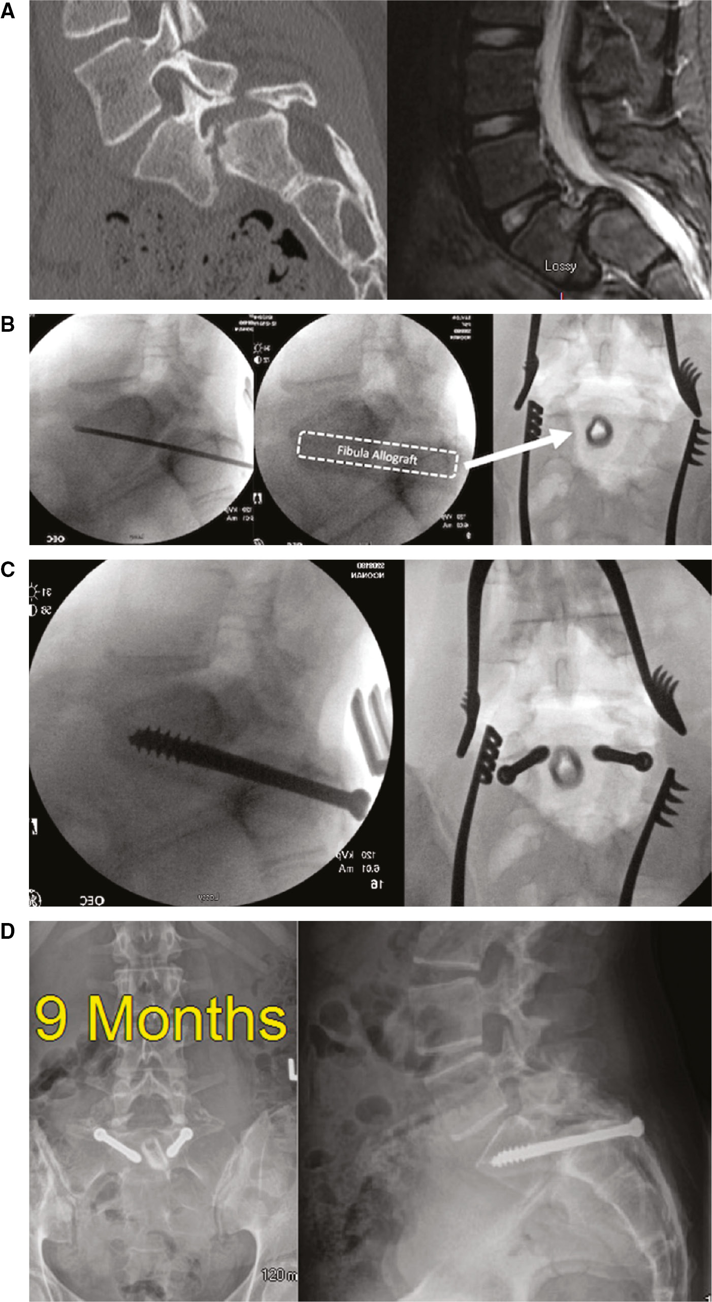 jposna2022545_fig2.jpg