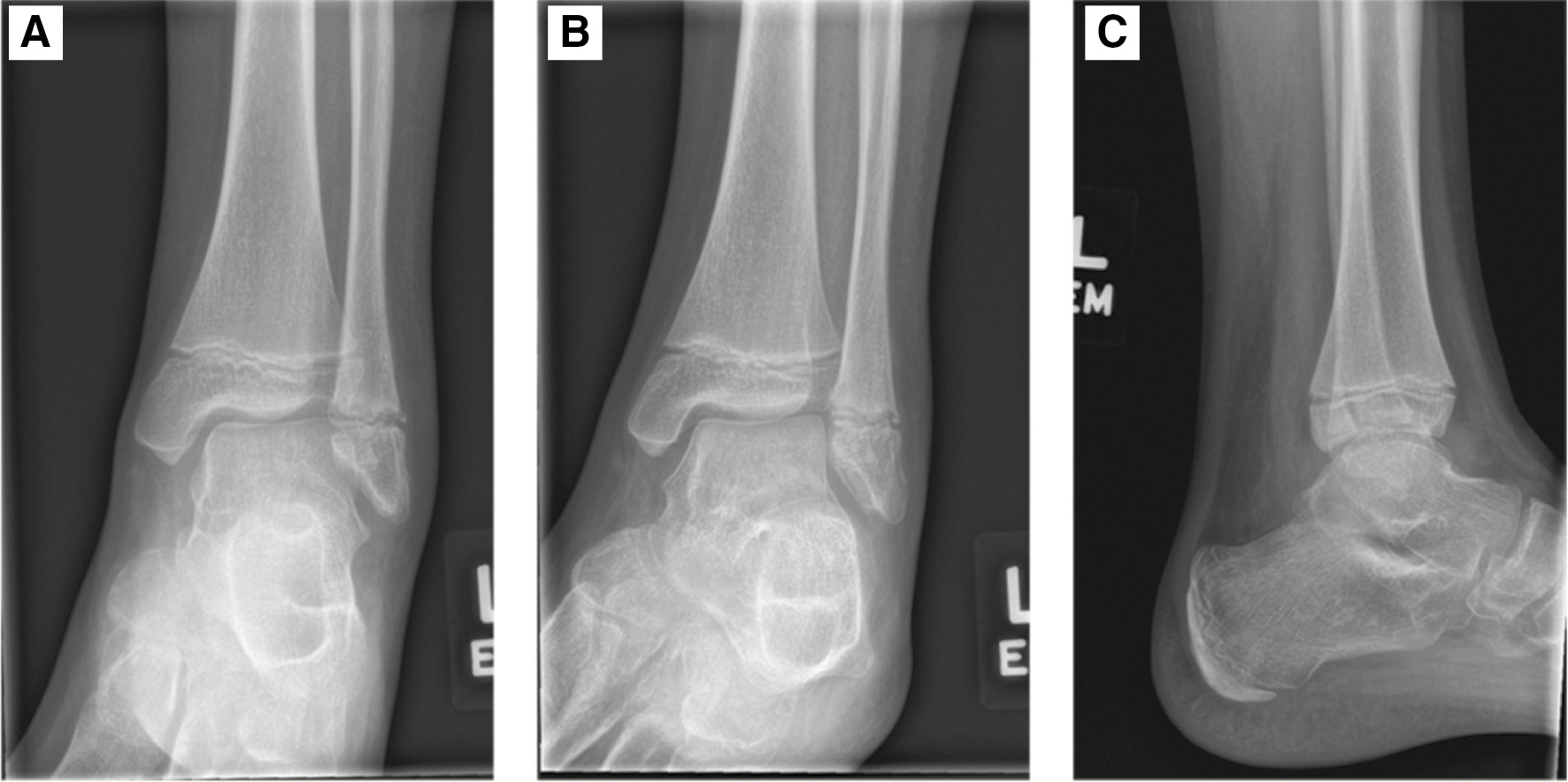 jposna2022553_fig3.jpg