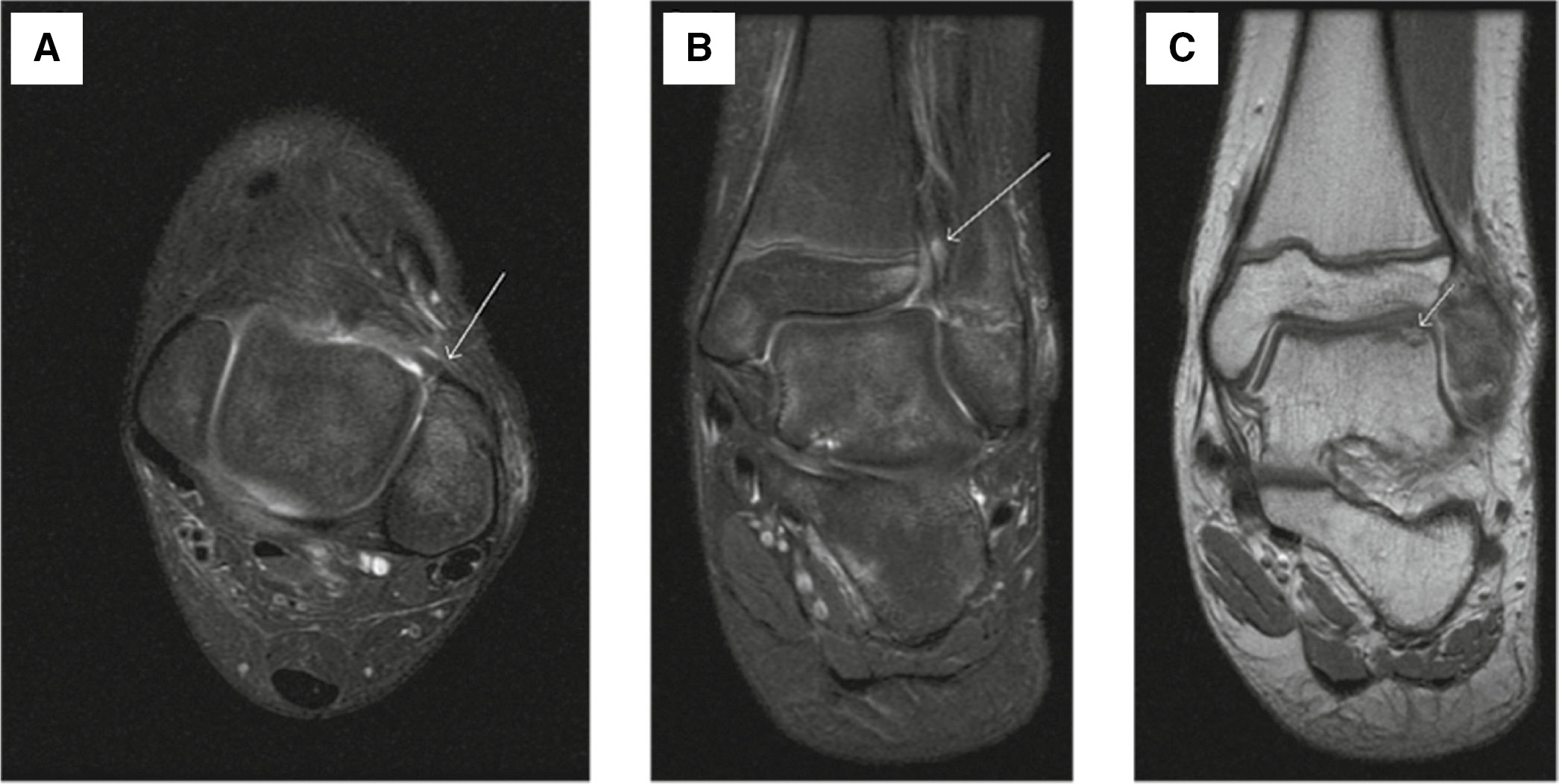 jposna2022553_fig5.jpg