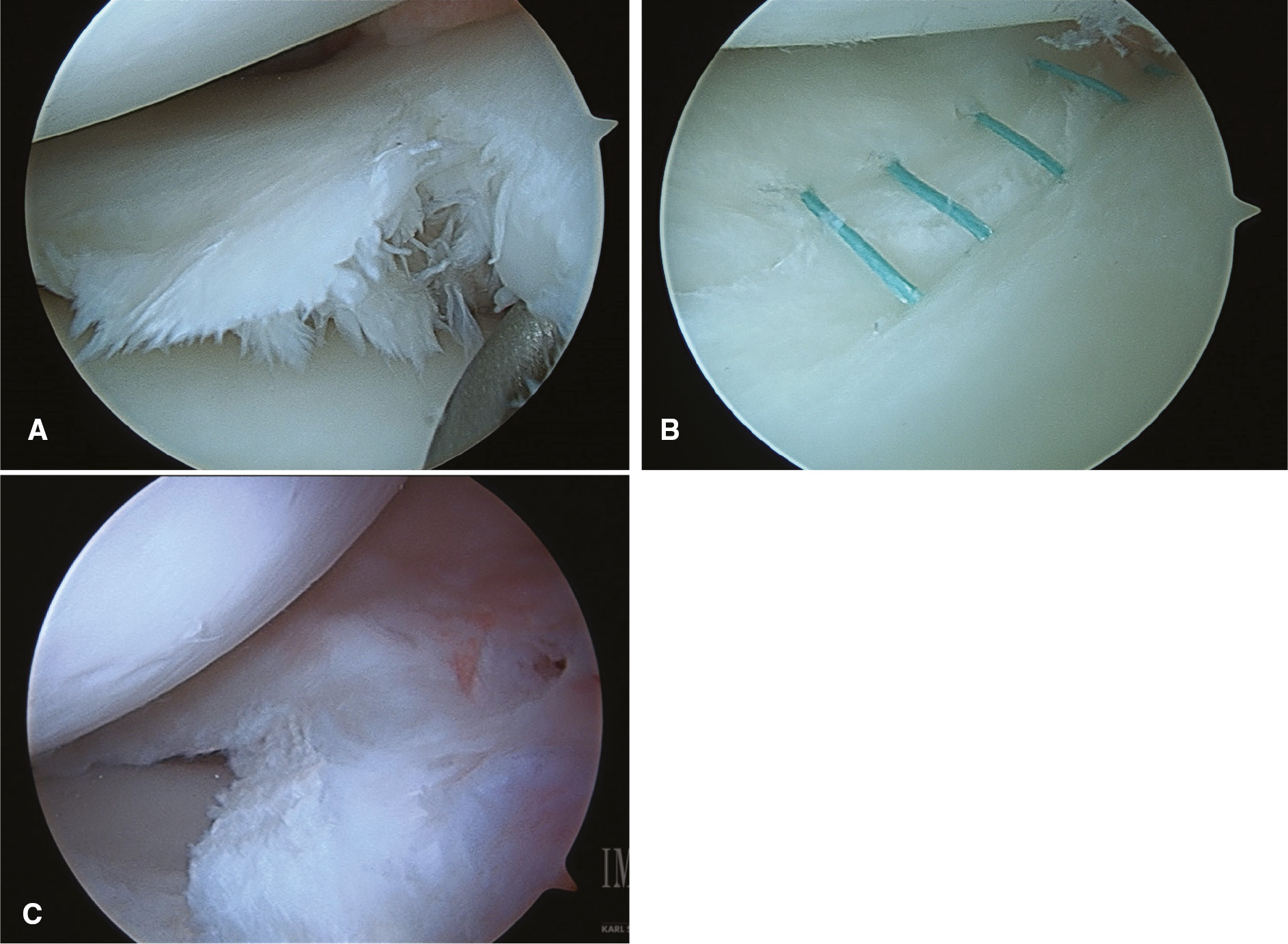 jposna2023563_fig4.jpg