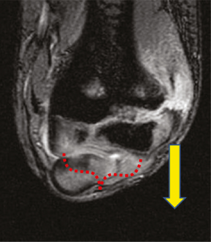 jposna2023632_fig1.jpg