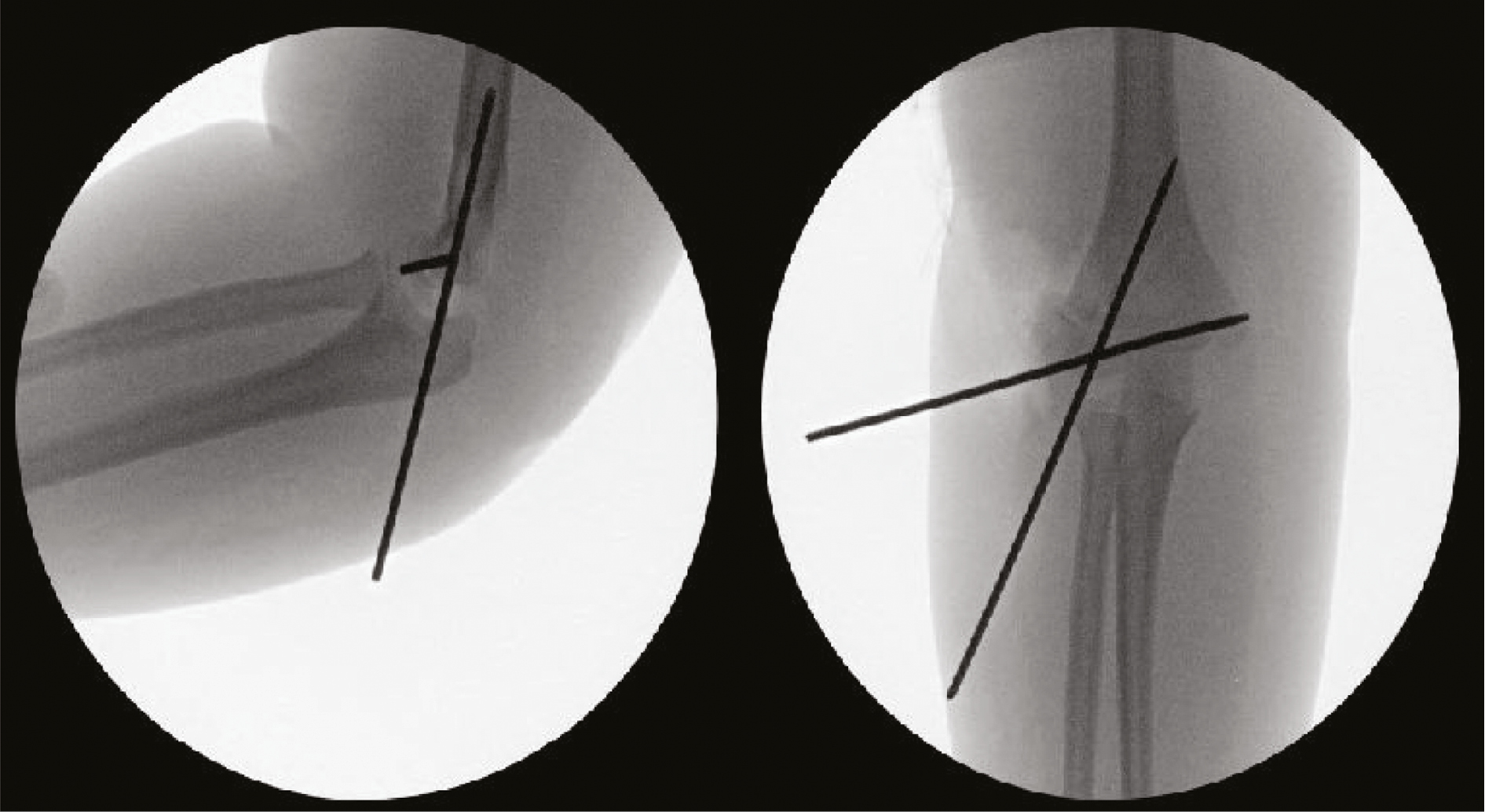 jposna2023632_fig14.jpg