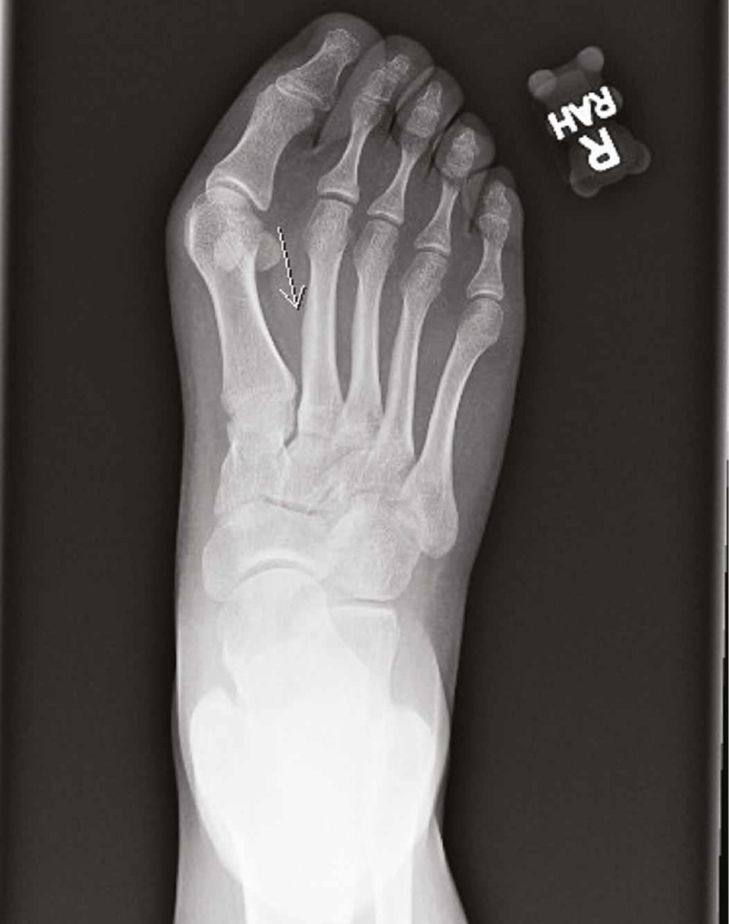 jposna2023745_fig2.jpg