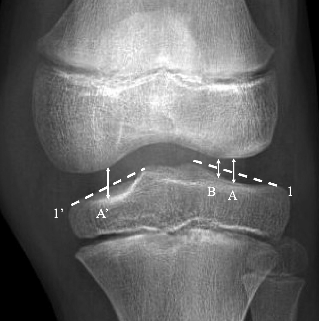 jposna2023756_fig1.jpg